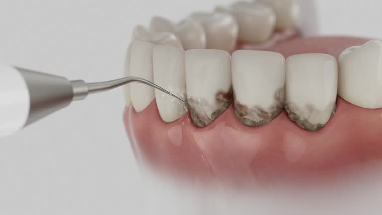 Trusted Dental Crowns And Bridges service in Union Mill, VA - Dentist Open Now